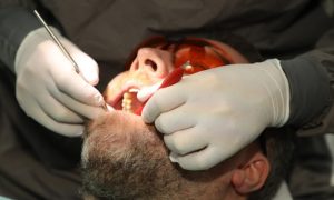 Kombinasjonen covid-19 og tannfestesykdommen periodontitt kan være ekstra alvorlig